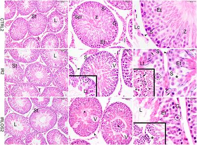Losartan Attenuates Radiation-Induced Damage on Testes and Accelerates Tubular Regeneration